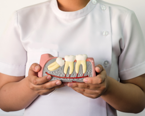 wisdom teeth diagram