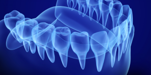 digital model of a lower jaw